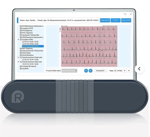 Wellue er1 ekg ecg monitor - wellue,