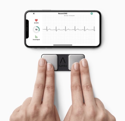 Alivecor kardia mobiles ekg - alivecor,